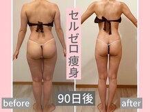 Re:Meの雰囲気（40代女性産後で痩せにくくなった身体を変えたい！ー８キロ痩せ）