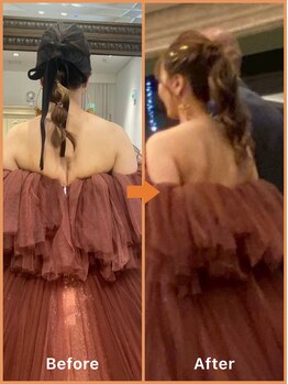 ポノ インディバ サロン(pono. Indiba salon)/背中すっきり花嫁♪