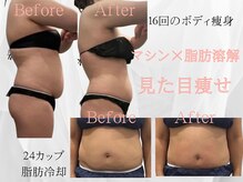 ティパニボーテ(Tipani Beaute')