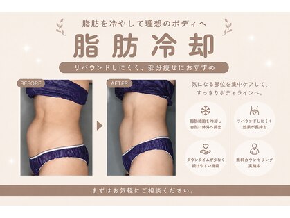 シュシュ(chouchou)の写真