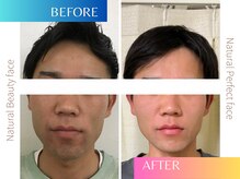 ナチュラルビューティーフェイス 横浜(NBF)/メンズ小顔矯正/歪み改善/左右差
