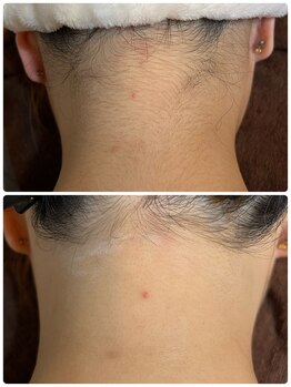 ノノ(nono)/首回りもスッキリ♪