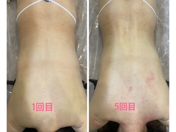 ルプリュシュ ルフレ(Le plus reflet)/カッピング1ヶ月通い放題!