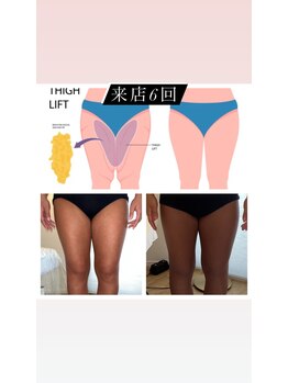 ウラヤス 恵比寿(Urayasu)/少ない回数で下半身やせ