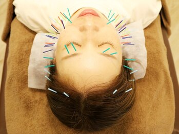 ウル鍼灸整骨院/美容鍼♪