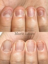 マリーロール 梅田店(Marie Laure)/深爪改善/自爪育成/ネイルケア