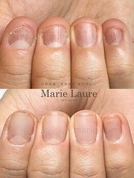 マリーロール 梅田店(Marie Laure)/深爪改善/自爪育成/ネイルケア