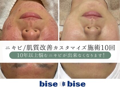 ビズビズ 梅田店(bisebise)の写真
