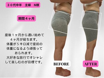 ビジリンヌ/ビフォーアフター4ヶ月