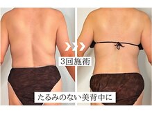 リュシータ 吹田千里丘店(LUSHEETA)/【 VENUS痩身 】(50代前半)