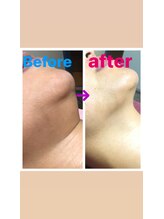 南国 蒼 越谷(ao)/細胞ケアビフォーアフター