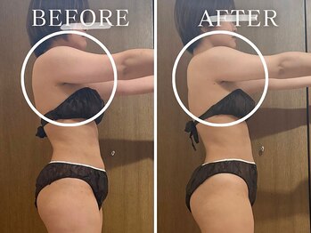 ヨサパーク ニコナ 三軒茶屋南口(YOSA PARK nicona)/結果重視！二の腕スッキリ♪