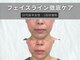 エードットクリニカルサロン 横浜(a.clinicalsalon)の写真/【最先端☆本格小顔ケアで若々しい見た目へ】たるみを改善！お肌の内側から潤うハリツヤ肌に♪看護師施術◎