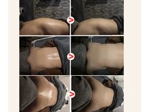 カプリーズ マース(Caprice MARS)の雰囲気（経絡リンパボディケアの施術前後の変化です。）