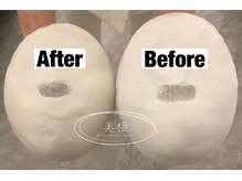 美極 銀座店/銀座/小顔コルギ/小顔矯正