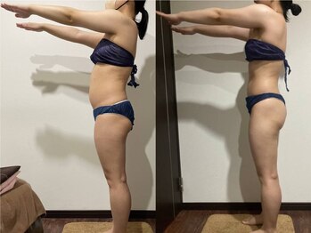 プリオール 高崎花水木店(Prior)/セルマジック痩身/全身痩身