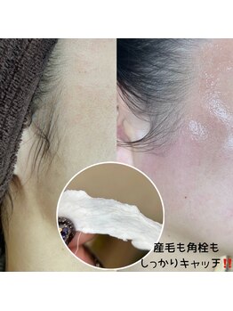 プルティティア(Pultitia)/