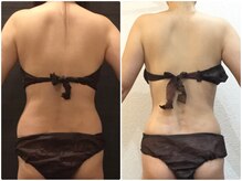 美容整体ウェリナ 名駅院/小顔矯正/骨盤矯正/美脚サロン