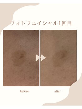 シャルム(Charme)/