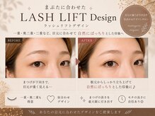 まつげの恵