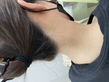 ナノハナ/鹿沼市全身脱毛美容室ナノハナ