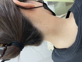 ナノハナ/鹿沼市全身脱毛美容室ナノハナ