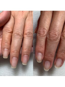 ネイルルーム ナップ(Nail Room Nap)/自爪育成