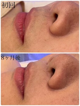 スリーズララ(Cerise LaLa)/