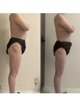 フェミニー(Feminy)/全身デトックス！！