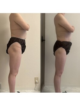 フェミニー(Feminy)/全身デトックス！！