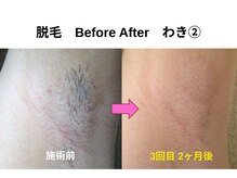 シンプルケアで毎日が快適に。