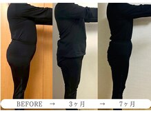 ヨサパーク ノワール(YOSA PARK Noir)/3ヶ月・7ヶ月before/after 1