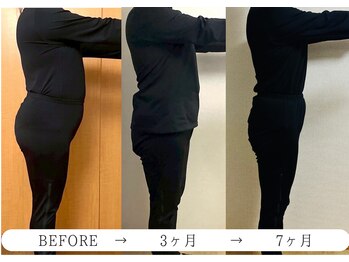 ヨサパーク ノワール(YOSA PARK Noir)/3ヶ月・7ヶ月before/after 1