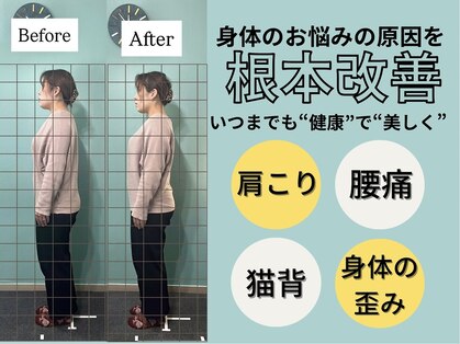 ハチ(HACHI)の写真