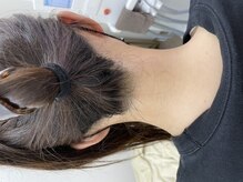 ナノハナ/鹿沼市全身脱毛美容室ナノハナ