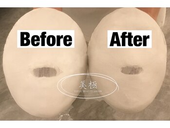 美極 銀座店/銀座/小顔コルギ/小顔矯正