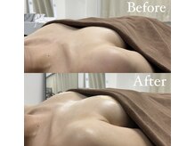 ブレスト サロン 奈良店(Bryst Salon)/バストアップ症例