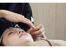 ゼニストウキョウ(Zenith Tokyo)/頭皮鍼も。眼精疲労の原因撃退。