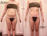 エンダモロジーアライアンス★60分5回★大人女性の為の痩身