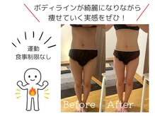 高津駅で痩身が人気のエステサロン｜ホットペッパービューティー