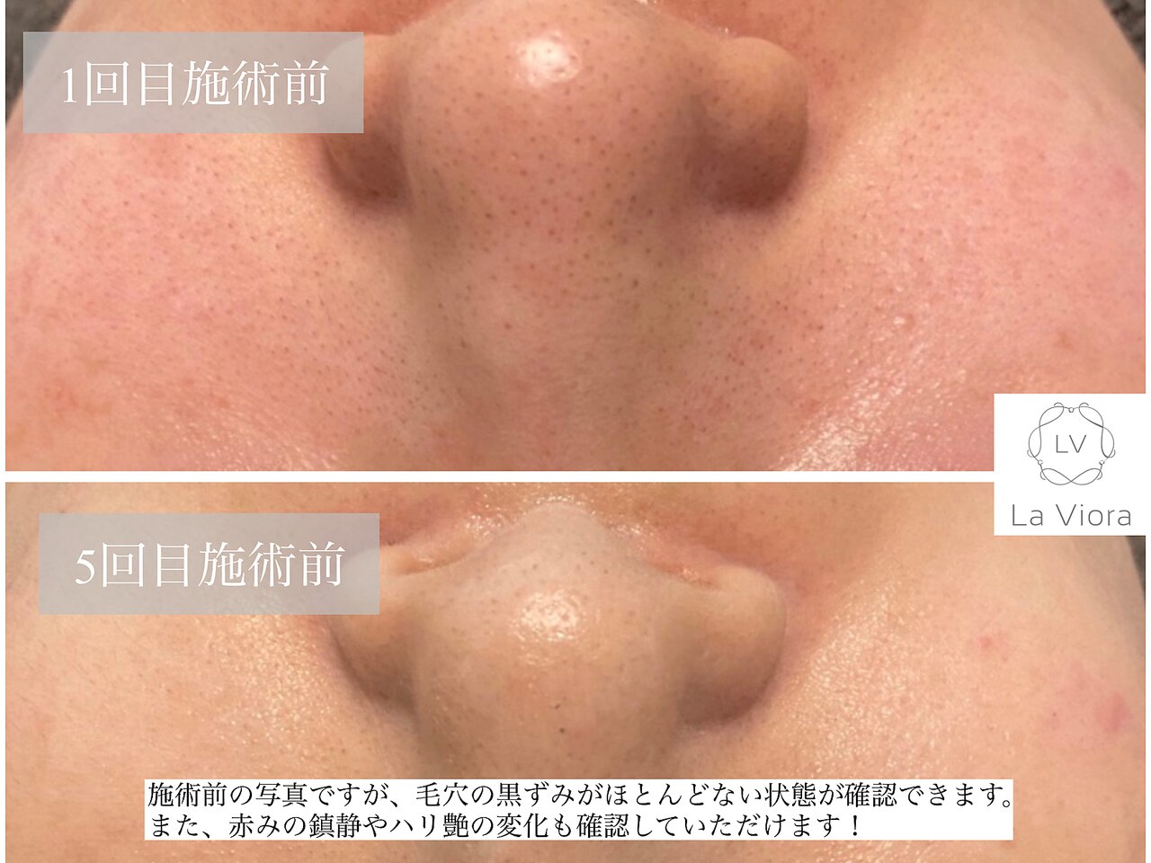 フォト3ページ目｜ラヴィオーラ 神戸三宮店(La Viora)｜ホットペッパー