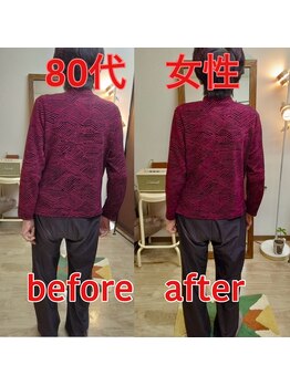 カイロプラクティック 整体 三日月/姿勢の変化　80代の方です