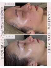 ルリエベル(Relier Belle)/最新肌育ピーリング