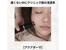 ソラ 菊陽光の森(SOLA+)の雰囲気（毛穴/シミ/美白/黒ずみ/シワ/美肌/ニキビ/跡/毛穴/痩身）