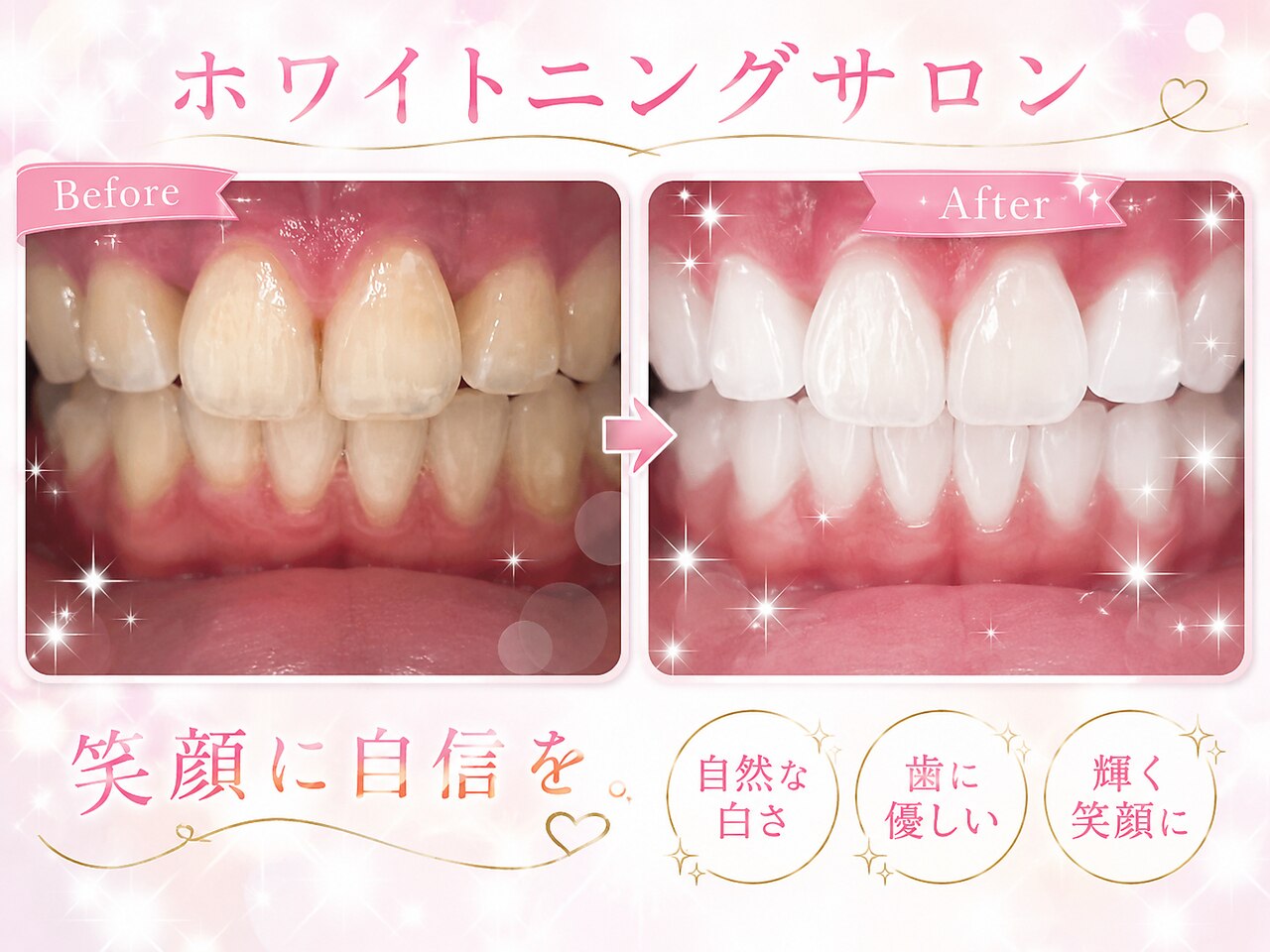ホワイトニングショップ 守谷店(whitening shop)｜ホットペッパー