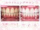 ホワイトニングショップ 守谷店(whitening shop)の写真