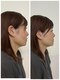 プラスチャーム(+charm)の写真/脂肪燃焼やダイエット効果を目指す方へ。毎分900ml水素が発生の最強コースで輝こう◎