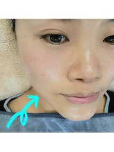 ユープラス(you+)/