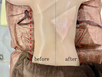 レイジュ(reiju)/【サーモシェイプDeep】1回