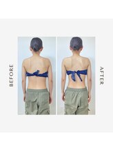 ルーチェビューティープラス(LUCE' beauty +)/肩甲骨剥がし